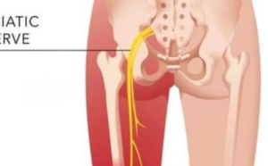 পা অবশ হওয়ার কারণ ও প্রতিকার